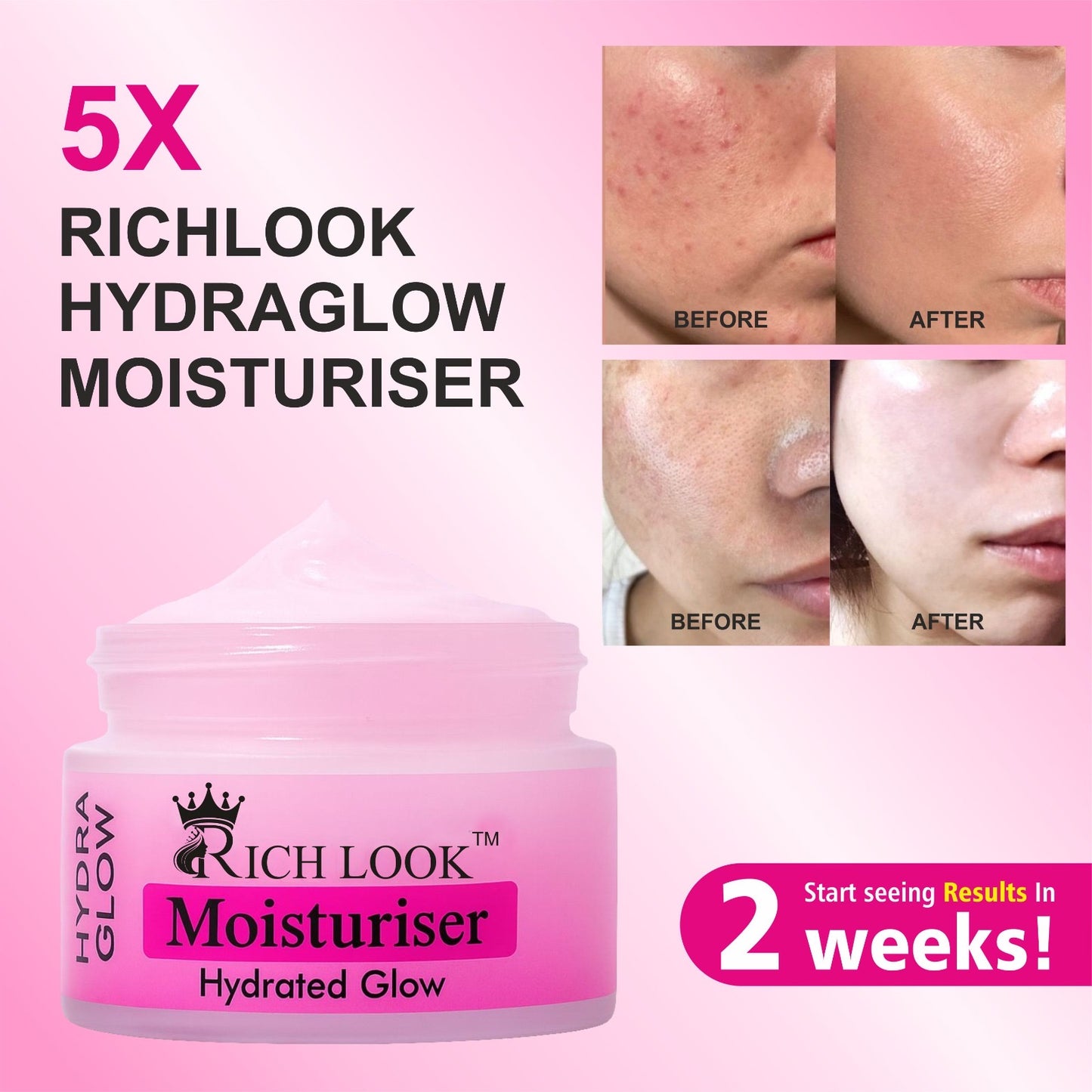 MOISTURIZING DAY CREAM Spf 50+ (Hydrated Glow with Hyaluronic Acid)