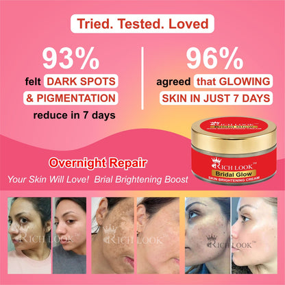 50 grams - BRIDAL GLOW - Skin Brightening in 6 days- Dark Spots & Dullness removal cream - Ultra Fairness & Glow Booster Night Cream.